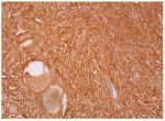podoplanin (FL-162): sc-134482. Immunoperoxidase staining of formalin fixed, paraffin-embedded human ovary tissue showing cytoplasmic staining of follicle cells and cytoplasmic and membrane staining of ovarian stroma cells.