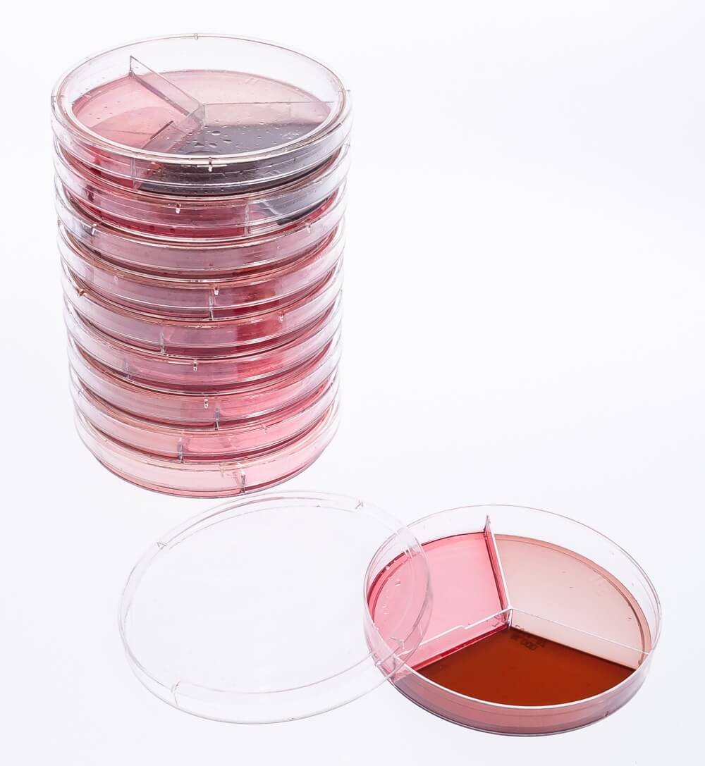 Blood Agar (tsa 5%)   Macconkey Agar   Mannitol Salt Agar, Triplate 