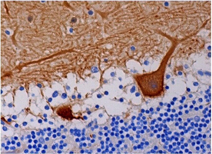 parvalbumin α Antibody (N19) Santa Cruz Biotech