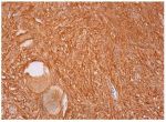 podoplanin (FL-162): sc-134482. Immunoperoxidase staining of formalin fixed, paraffin-embedded human ovary tissue showing cytoplasmic staining of follicle cells and cytoplasmic and membrane staining of ovarian stroma cells.