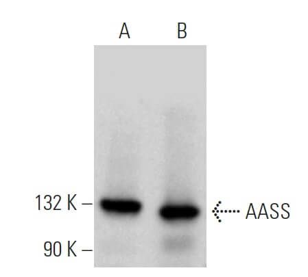 AASS抗体 B 7 SCBT Santa Cruz Biotechnology