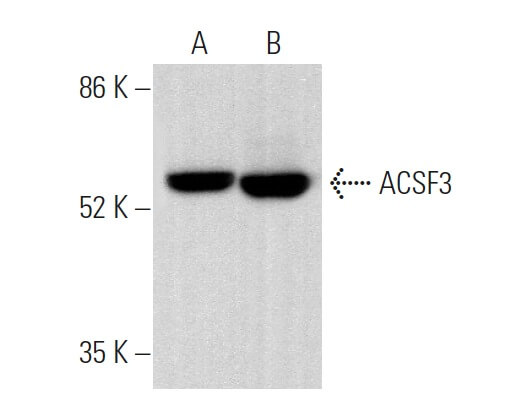 Anti Acsf Antibody F Scbt Santa Cruz Biotechnology