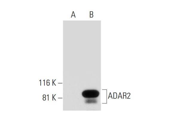 ADAR2抗体 A 5 SCBT Santa Cruz Biotechnology