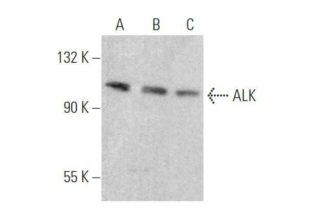 ALK抗体 ALK1 SCBT Santa Cruz Biotechnology