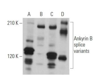 Ankyrin B Antibody 2 20 Western Blotting Image 369801