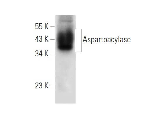 Aspartoacylase Antibody F Scbt Santa Cruz Biotechnology