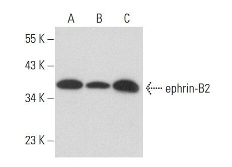 Ephrin B Antibody F Scbt Santa Cruz Biotechnology