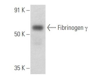 Fibrinogen γ 항체 2 G2 H9 SCBT Santa Cruz Biotechnology