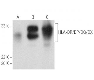 HLA DR DP DQ DX Antibody CR3 43 Western Blotting Image 389372