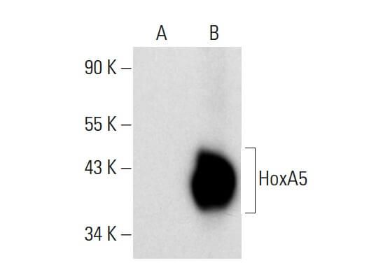 Hoxa Antibody C Scbt Santa Cruz Biotechnology