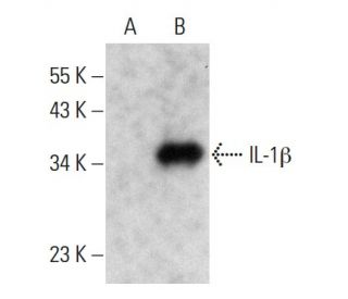 Il Beta Il B Antibody H Scbt Santa Cruz Biotechnology