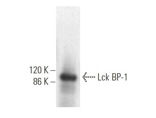 Anti Lck Bp Antibody B Scbt Santa Cruz Biotechnology