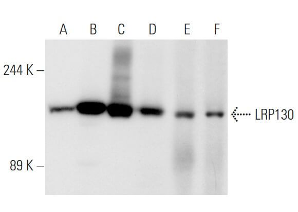 Lrp F Scbt Santa Cruz Biotechnology