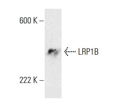 Lrp B Antibody Ct Scbt Santa Cruz Biotechnology