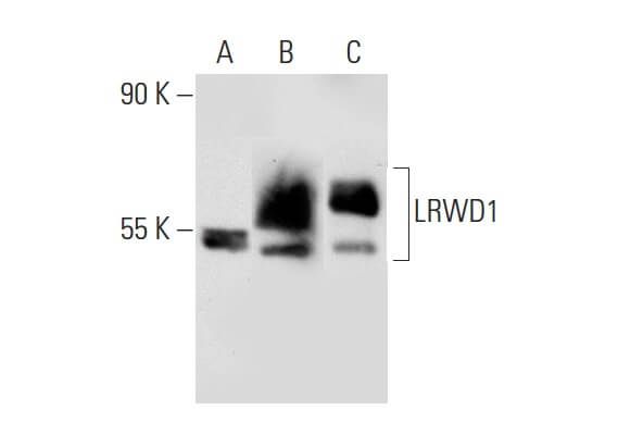 SCBT Santa Cruz Biotechnology