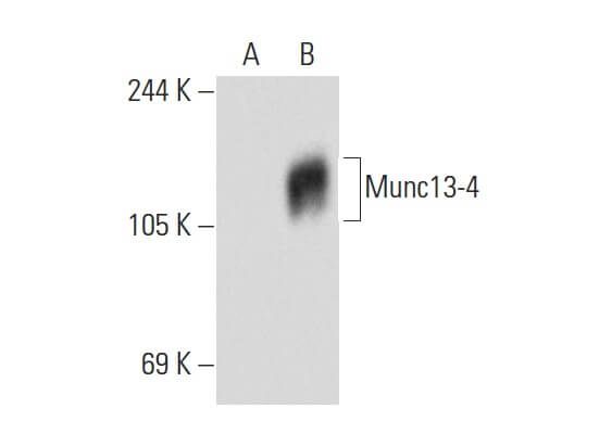 Munc C Scbt Santa Cruz Biotechnology