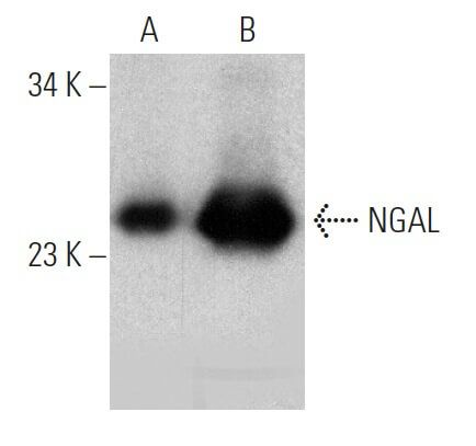 NGAL抗体 H 7 SCBT Santa Cruz Biotechnology