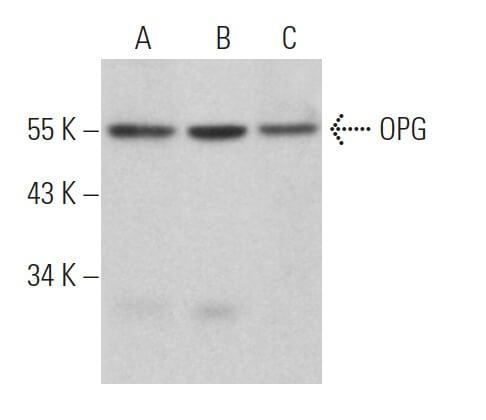 OPG Osteoprotegerin Antibody E 10 SCBT Santa Cruz Biotechnology