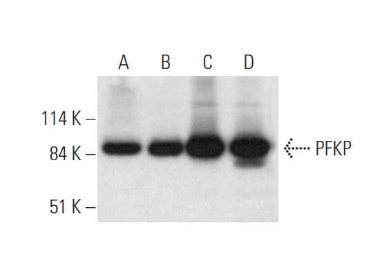 Pfkp F Scbt Santa Cruz Biotechnology