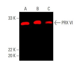 Anti Prx Vi Antibody D Scbt Santa Cruz Biotechnology