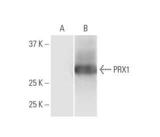 Anti Prx Antibody E Scbt Santa Cruz Biotechnology