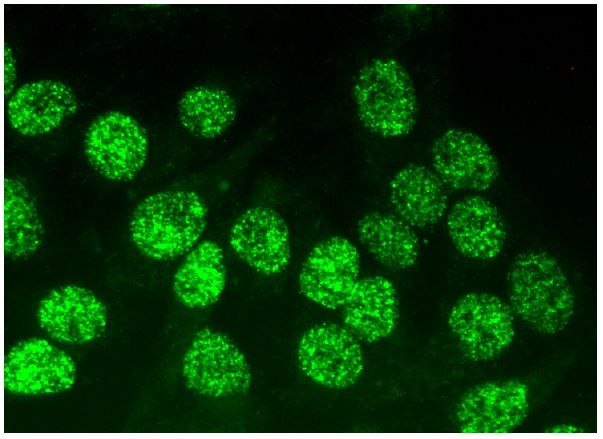 Rad52 Antibody F 7 SCBT Santa Cruz Biotechnology