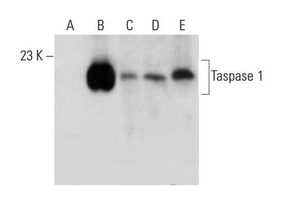 Taspase Anticuerpo F Scbt Santa Cruz Biotechnology