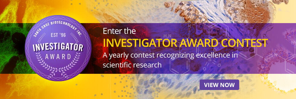 The Santa Cruz Biotechnology Investigator Award recognizes excellence in scientific research.