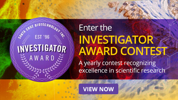 The Santa Cruz Biotechnology Investigator Award recognizes excellence in scientific research.