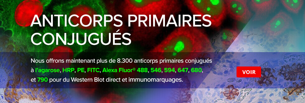 Direct conjugated primary antibodies for Western blotting and staining.