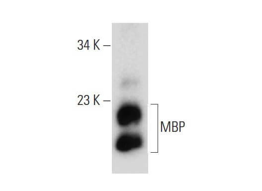 Anti MBP (F-6)（SCB-SC271524-200UG[200 μg/ml]）（カテゴリ