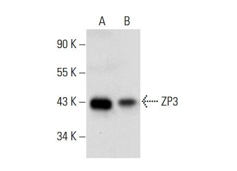 ちゃむ ページ 超低頭精密ねじ(E2) Aセット YAHATA 精密ネジ Aセット パック