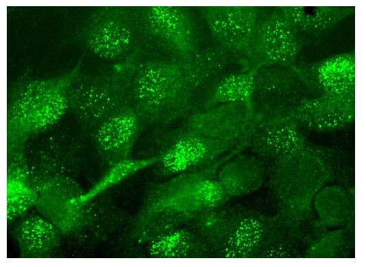 DDB1 Antibody (B-1) | Santa Cruz Biotech