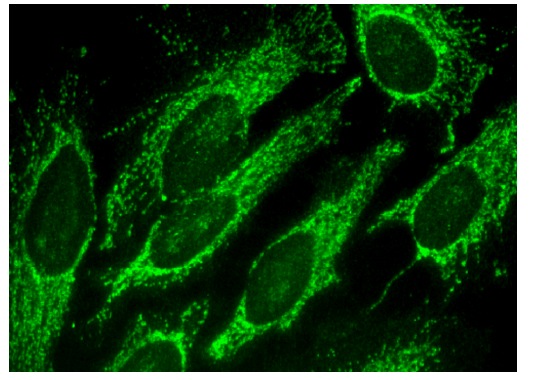 VEGF-B Antibody (H-70) | Santa Cruz Biotech