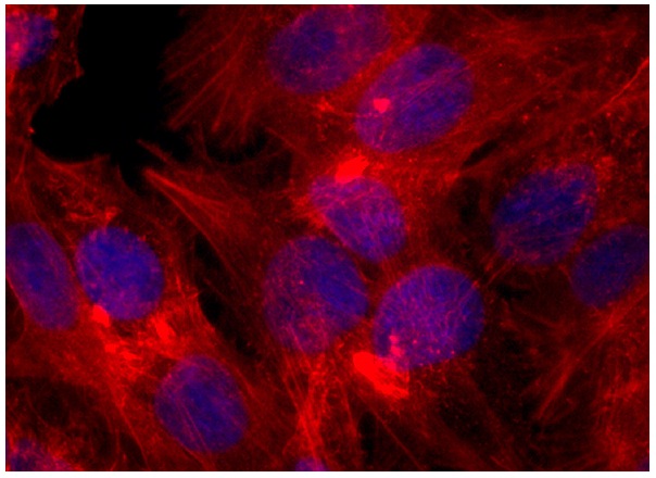 Phalloidin CruzFluor™ 555 Conjugate | Santa Cruz Biotech