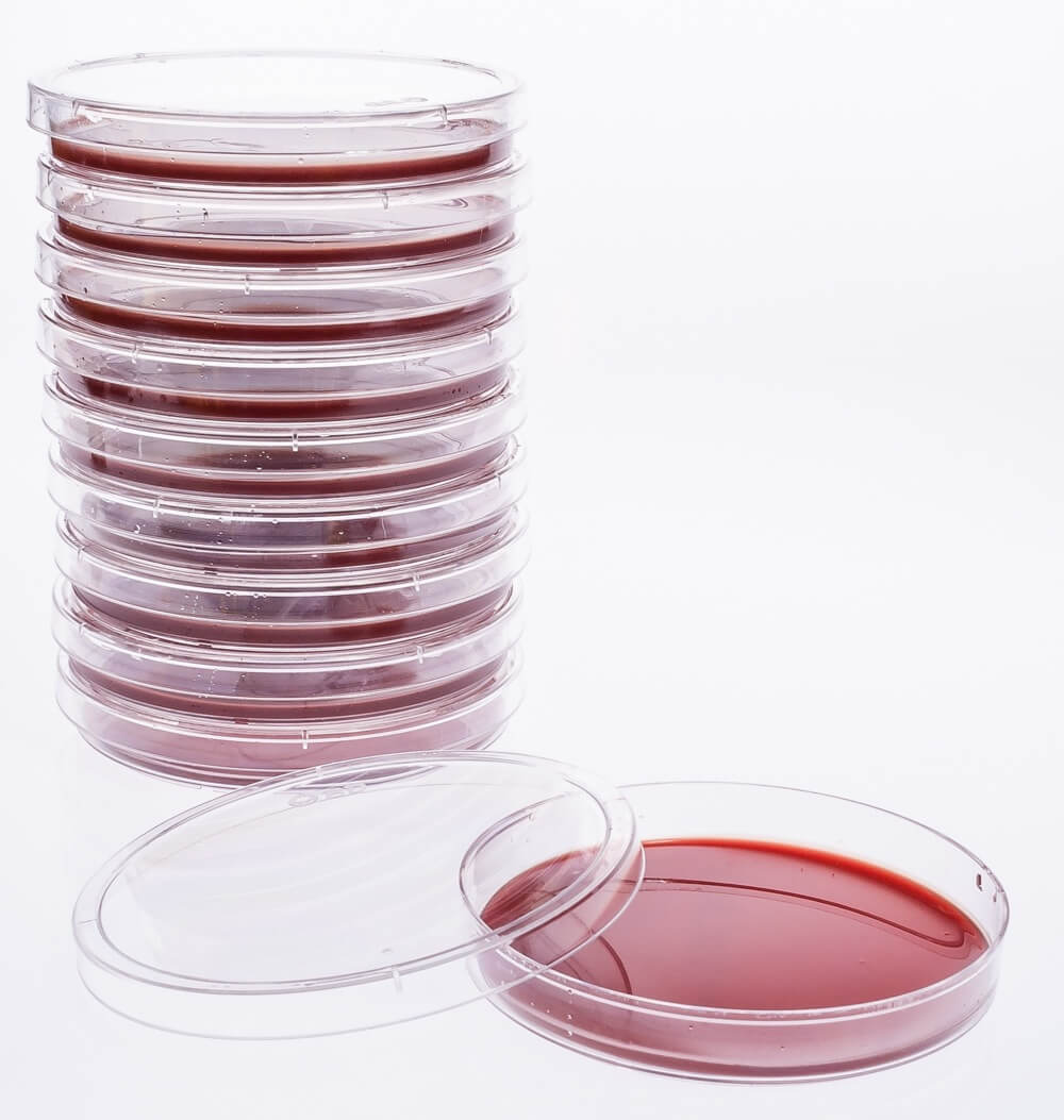 Blood Agar TSA w/5% Sheeps Blood, Monoplate, 20/pk | Santa Cruz Animal ...