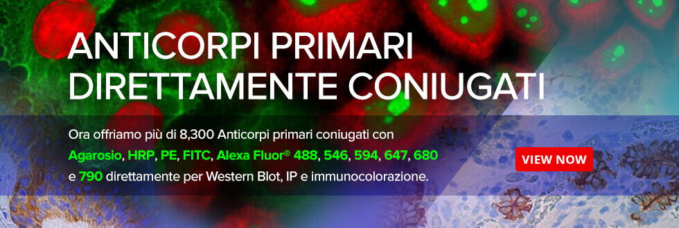Direct conjugated primary antibodies for Western blotting and staining.