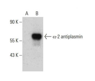 α-2 antiplasmin Antibody (C-7) - Western Blotting - Image 387355Each CRISPR/Cas9 Knockout (KO) Plasmid product consists of a pool of 3 plasmids designed to ensure identification and cleavage of a specific gene for maximum knockout efficiency. Each plasmid encodes a unique 20 nt sequence derived from the GeCKO (v2) library.