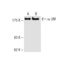 &alpha;-2M Antibody (2D9) - Western Blotting - Image 62835 