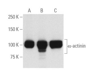 &alpha;-actinin Antibody (H-2) - Western Blotting - Image 5157 