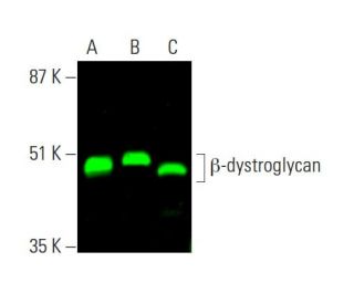 β-dystroglycan Antibody (4F7) - Western Blotting - Image 382010