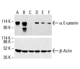 α E-catenin Antibody (G-11) - Western Blotting - Image 412261