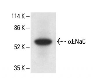 &alpha;ENaC Antibody (H-6) - Western Blotting - Image 411773The Double Nickase Plasmid features a U6 promoter for sgRNA expression, a 20 nt targeting sequence, and a gRNA scaffold to guide Cas9n. It includes a CBh promoter for Cas9n (D10A) and puromycin resistance, GFP for transfection verification, and nuclear localization signals (NLS). The 2A peptide allows co-expression of Cas9n and Puro from a single promoter, enabling precise genome editing with reduced off-target effects. 