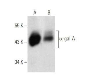 α-gal A Antibody (C6) - Western Blotting - Image 374581The Double Nickase Plasmid features a U6 promoter for sgRNA expression, a 20 nt targeting sequence, and a gRNA scaffold to guide Cas9n. It includes a CBh promoter for Cas9n (D10A) and puromycin resistance, GFP for transfection verification, and nuclear localization signals (NLS). The 2A peptide allows co-expression of Cas9n and Puro from a single promoter, enabling precise genome editing with reduced off-target effects.