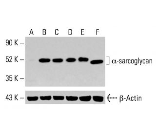 α-sarcoglycan Antibody (D-7) - Western Blotting - Image 413959