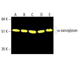 α-sarcoglycan Antibody (D-7) - Western Blotting - Image 413138