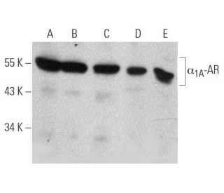 α<sub>1A</sub>-AR Antibody (4D8) - Western Blotting - Image 366640SAM Transcription Activation: SAM system utilizing dCas9-VP64, MS2-P65-HSF1, and sgRNA for precise gene transcription activation.