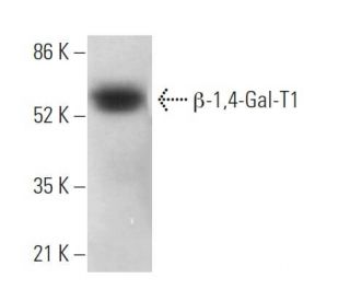 &beta;-1,4-Gal-T1 Antibody (A-3) - Western Blotting - Image 373457 