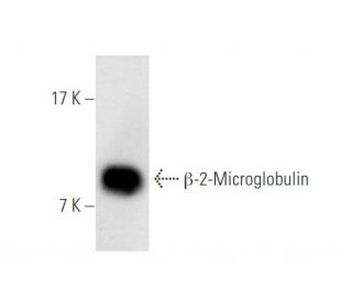 β-2-Microglobulin Antibody (G-10) - Western Blotting - Image 61975