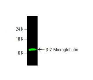 β-2-Microglobulin Antibody (G-10) - Western Blotting - Image 381609